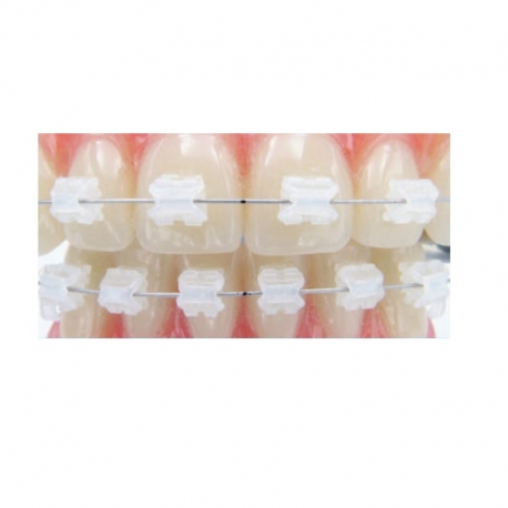 brackets-ceramici-sistem-aqua