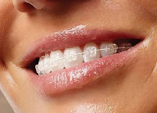 345653862_222133063896812_8141863833263227380_n - Copie